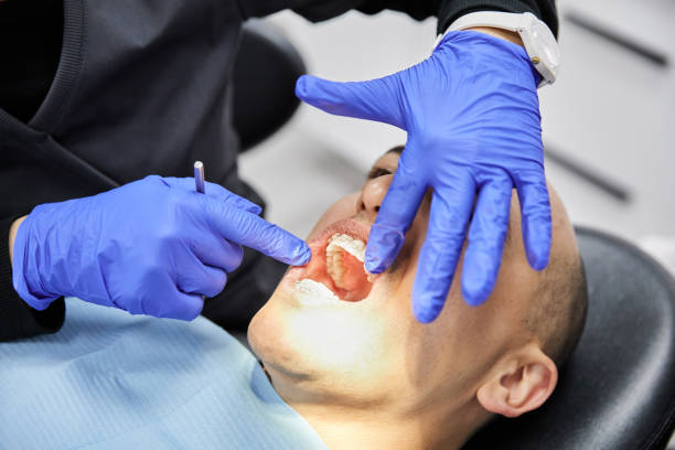 Best Broken Tooth Emergency  in Cheraw, SC