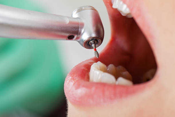 Best Emergency Gum Pain Relief  in Cheraw, SC